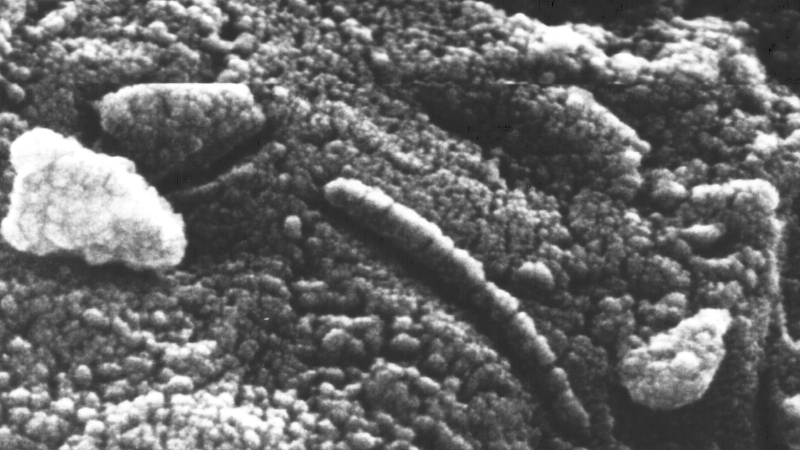 Grey blobs next to each other